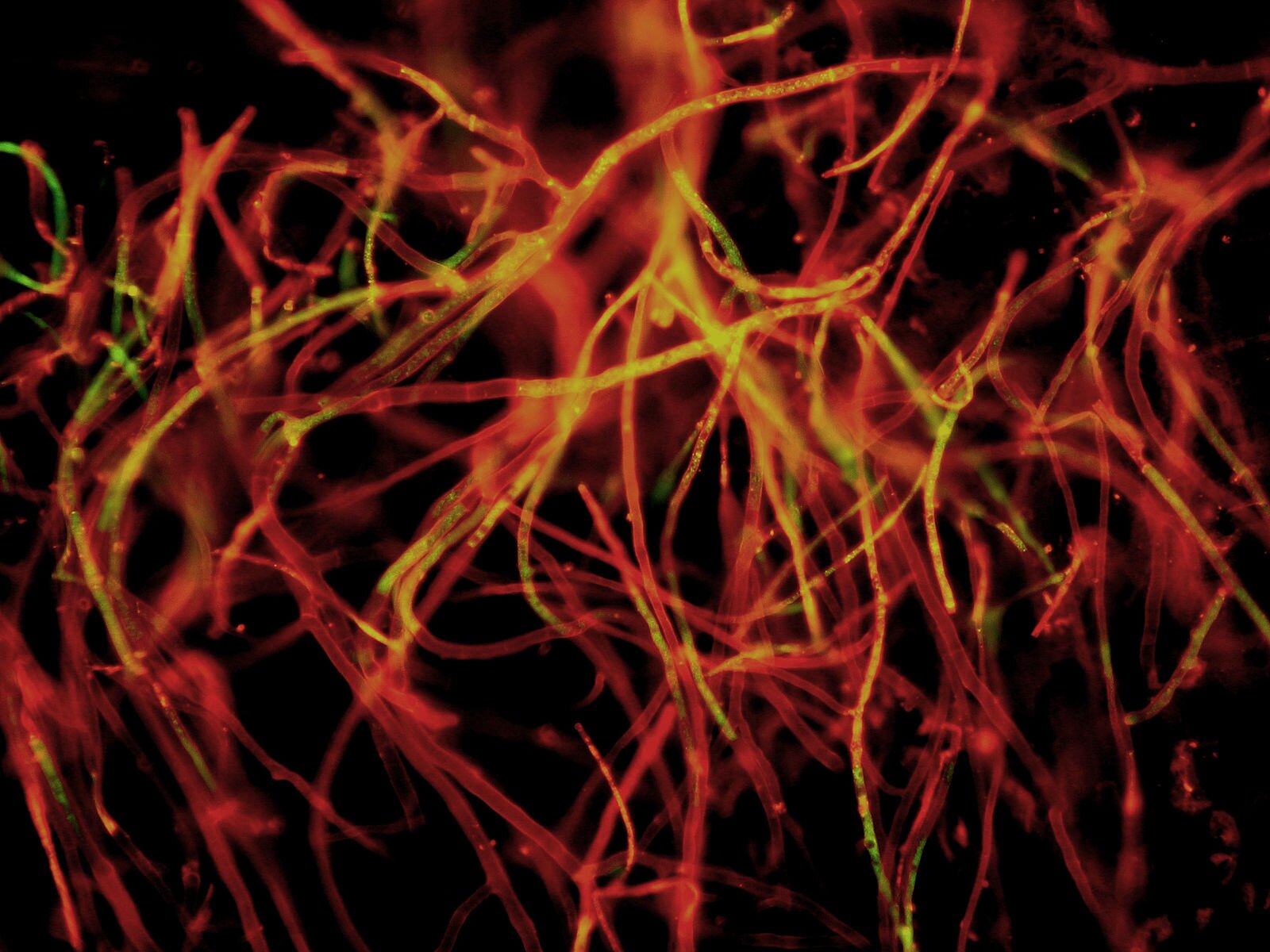 Soppen spinner sine tråder overalt. I dette mycelet er områder med høy metabolsk aktivitet – der næringsstoffer omdannes – merket med fluorescerende farge. Bildet er tatt med et høyoppløselig kamera festet til et fluorescensmikroskop. (Illustrasjonsfoto: Christian Scheckhuber/wikimedia commons)